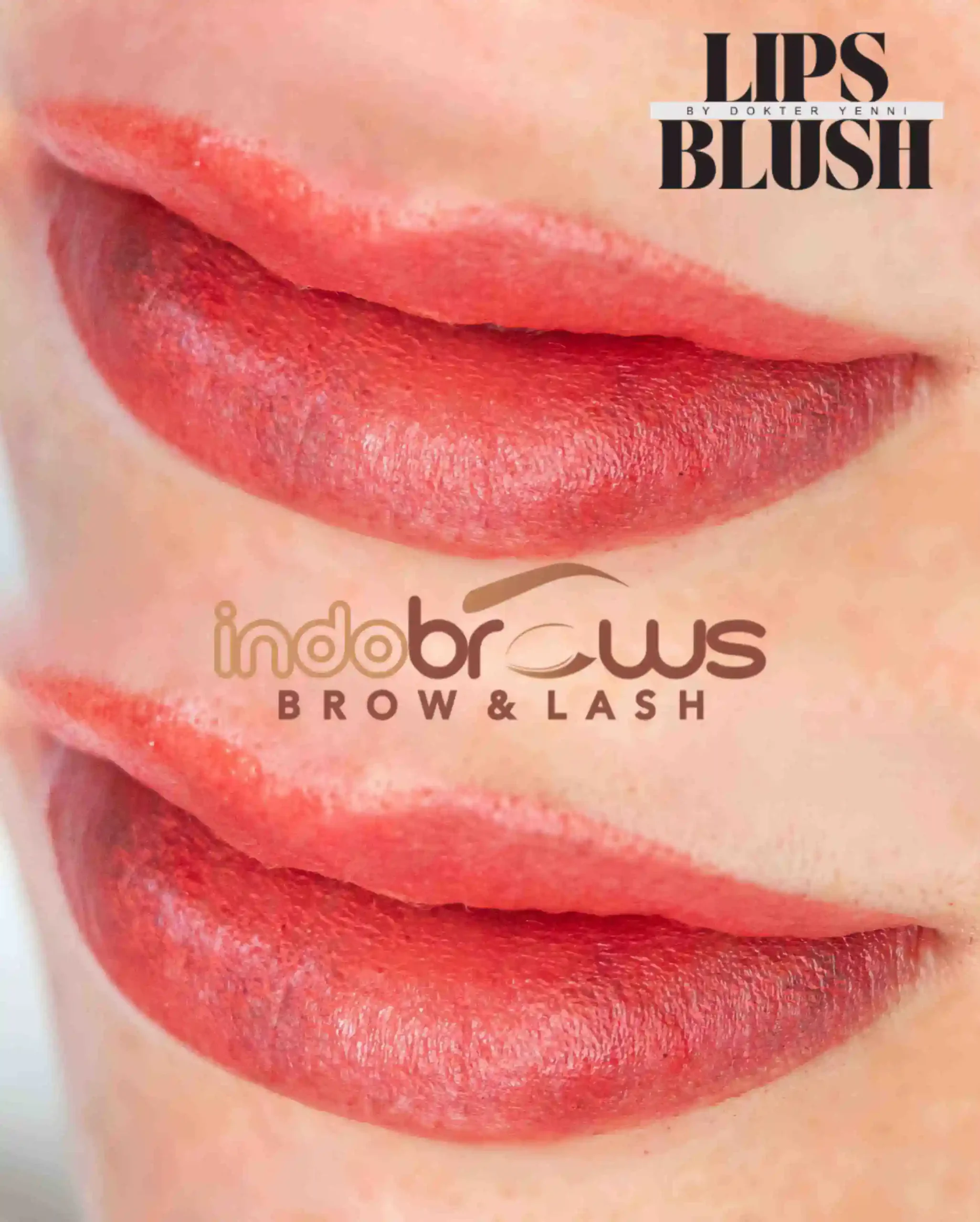 Lips-1-scaled.webp