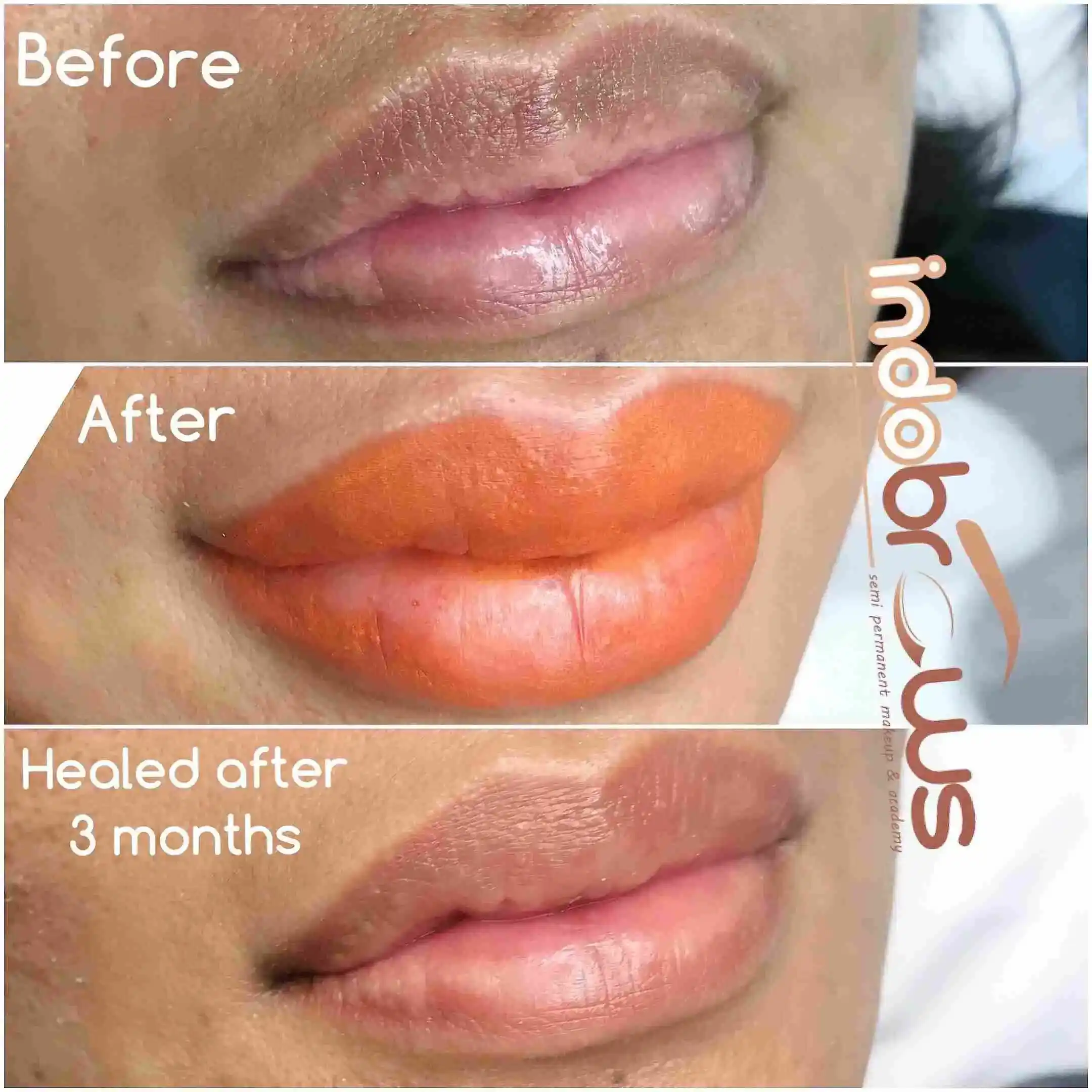 Lips-11.webp